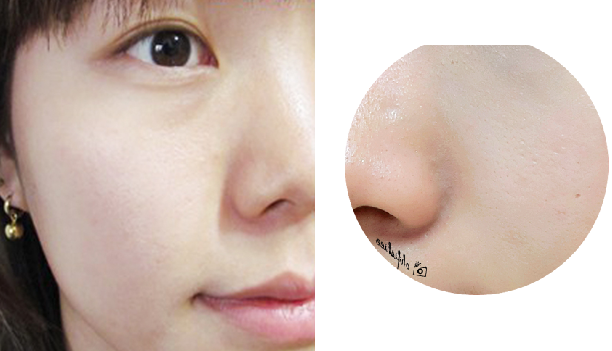 Bật mí 5 bước dưỡng trắng và se nhỏ lỗ chân lông mãi mãi không to trở lại