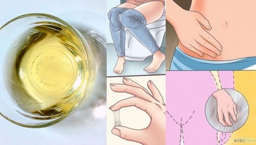 Mẹo trị ngứa "vùng kín" rẻ tiền, đơn giản ngay tại nhà