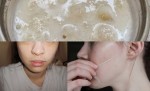 Dọn Mụn Đầu Đen Khi Đắp 2 Nguyên Liệu Này Chỉ Trong 5 Phút