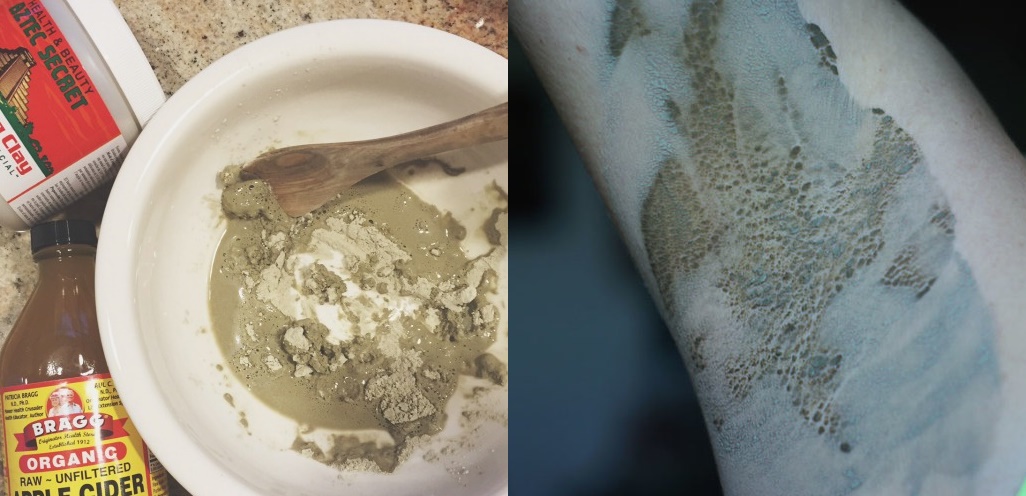 Đắp thứ này lên nách 5 phút: Thanh lọc 100% chất độc, chặn 98% ung thư vú