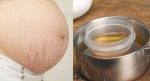 Đánh bay rạn da cho mẹ bầu chỉ với 2 nguyên liệu cực dễ tìm