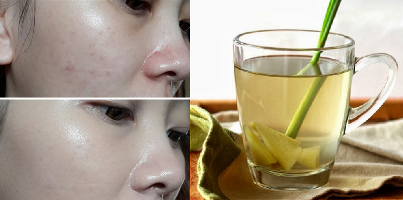 Da trắng mịn như gái Hàn nhờ xông mặt theo cách này 1 lần/tuần