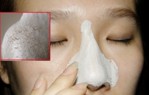 Chia sẻ cách giúp chị em chúng mình lột mụn để không lo lỗ chân lông bị to