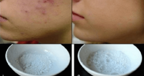 Chỉ cần 5 phút là da đẹp mịn màng với công thức sau