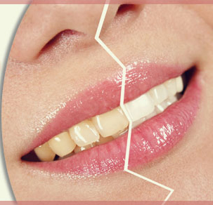 Tránh xa những đồ uống này nếu bạn không muốn bị vàng răng