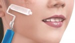 Các bước để điều trị sẹo sau tai nạn hiệu quả đến 80%