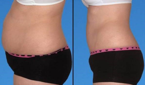 Thì ra đây chính là cách sử dụng nước chanh pha mật ong đúng chuẩn để giảm 13kg