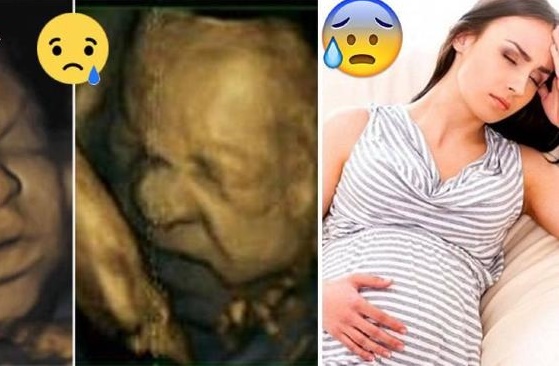 5 tư thế ngồi sai của bà bầu khiến mẹ đau đớn, con dễ bị thương tật vĩnh viễn