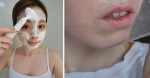 Các mẹo chăm sóc da siêu dễ giúp bạn tống khứ mụn đầu đen ở cằm trong chớp mắt