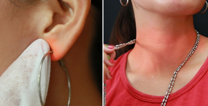 Cách đeo trang sức không bị ngứa rát, nhiễm trùng mưng mủ