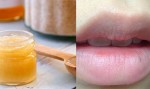 Thêm 1 công thức khiến môi thâm cỡ nào cũng hồng lên nhanh chóng