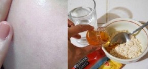 Chỉ trong 3 ngày, da em đã trắng mịn, giảm 80% mụn