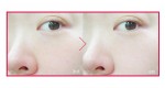 2 công thức trị tàn nhang hiệu quả cô nàng nào cũng nên thử 1 lần