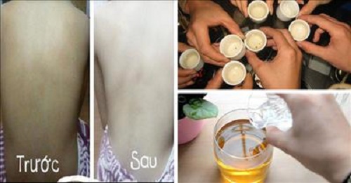 Tắm trắng tại nhà với rượu trắng cho da lên tông rõ rệt