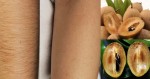 Cách triệt lông vĩnh viễn cả đời bằng nhựa quả hồng xiêm