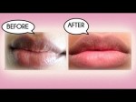 Mẹo làm hồng môi thâm ngay sau 1 đêm thức dậy