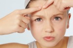 Những thức ăn là ‘thủ phạm’ gây ra mụn trứng cá