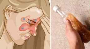 Viêm xoang lâu năm cũng hết ngay lập tức khi dùng hỗn hợp này