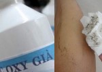 Tẩy sạch không còn 1 cọng lông tay, chân đơn giản chỉ từ 1 lọ oxy già