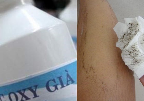Tẩy sạch không còn 1 cọng lông tay, chân đơn giản chỉ từ 1 lọ oxy già
