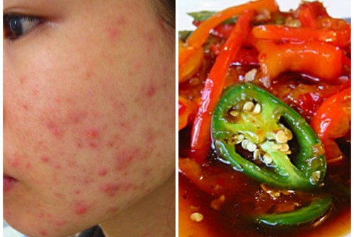 Thực phẩm mùa hè ăn vào là nhiệt miệng, mụn bùng phát, da xỉn màu