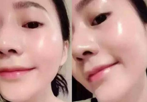 Da trắng &rsquo;cấp tốc&rsquo; chỉ sau 15 ngày, đảm bảo không bắt nắng, da lại vô cùng mịn