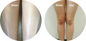 5 mặt nạ chăm sóc toàn thân để da luôn trắng hồng, căng mịn