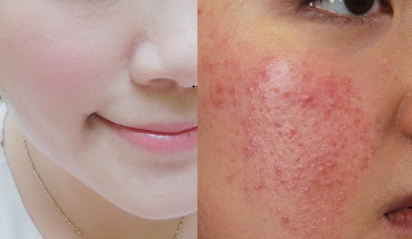 Da đang đẹp chợt xấu đi chóng vánh, đây là 5 lý do