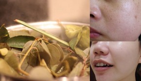 Cách xông hơi theo từng loại da giúp da trắng mượt hơn cả đi spa