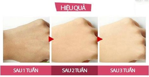 “Phát sốt” với “thần dược” cho da đẹp có giá chưa tới 10.000 đồng