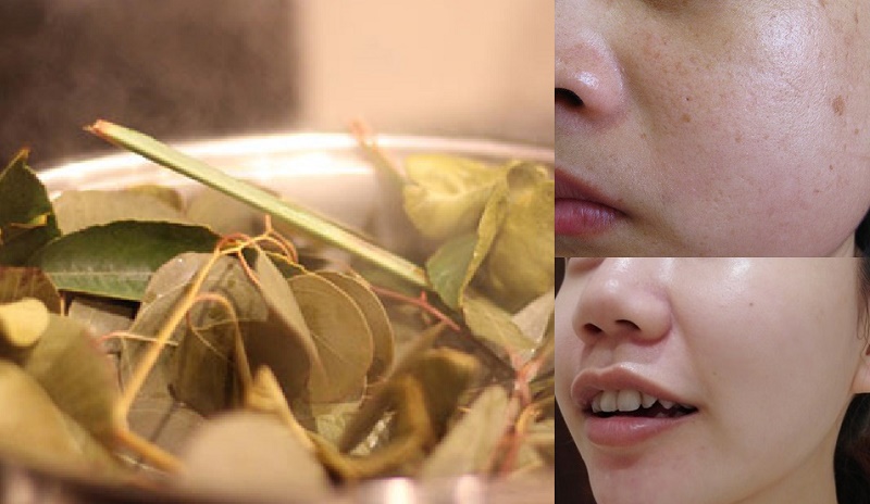 Cách xông hơi theo từng loại da giúp da trắng mượt hơn cả đi spa