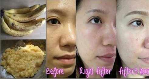 Mỹ phẩm đắt tiền cũng không sánh bằng 1 trái... chuối!