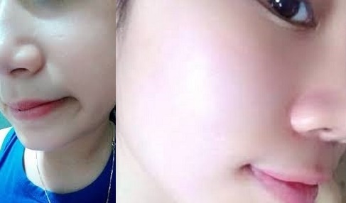 Dùng hỗn hợp này 15 phút, da căng mịn, trắng hồng hơn cả bôi kem sau  14 ngày