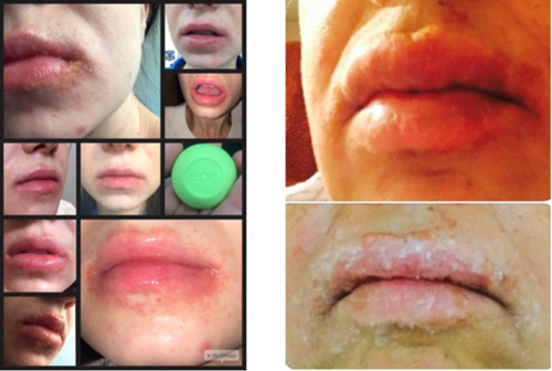Để không bị dị ứng mỹ phẩm, bạn hãy làm điều này!