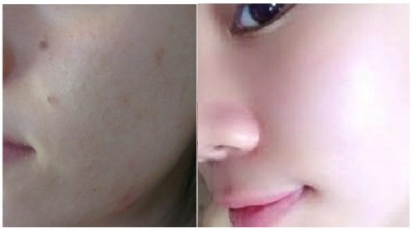 Đắp mặt nạ này để da sáng ngay sau khi rửa mặt