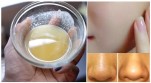 Da trắng mịn như gái 16 dù bạn đã ngoài 30 với bí quyết này
