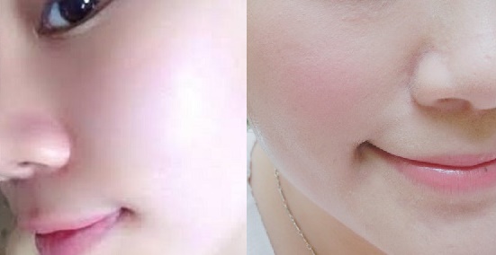 Biết mẹo đơn giản này làn da của bạn sẽ trắng hồng không bắt nắng