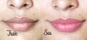 “Thần dược” có trong tủ bếp giúp trị môi thâm hiệu quả