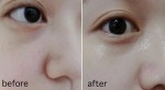 Da lão hóa chậm, không nếp nhăn và trắng mịn mà không tốn tiền