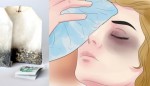 Mẹo hay loại bỏ thâm quầng mắt vĩnh viễn chỉ sau 1 đêm