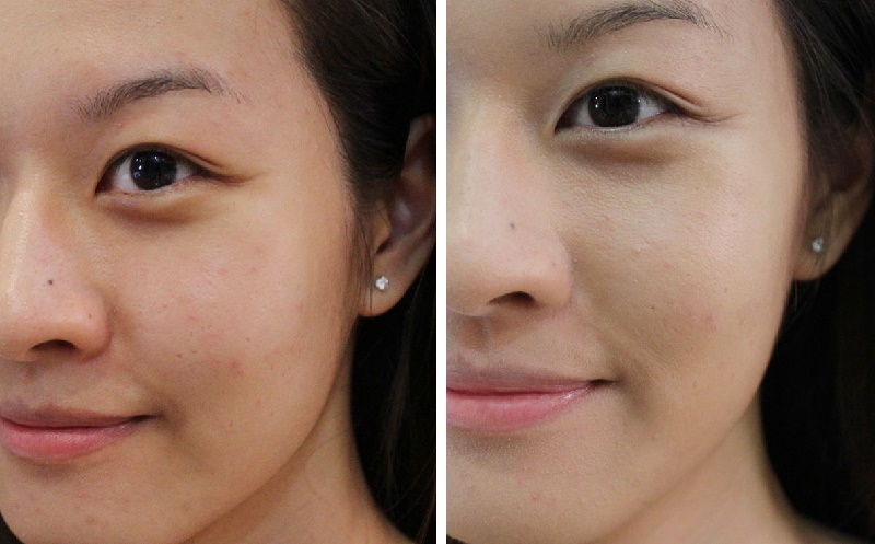 Chỉ cần thoa hỗn hợp này trước khi ngủ, da bạn sẽ trắng như bông bưởi
