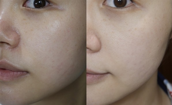 Đắp thứ này tuần 2 lần, da trắng hồng mà không cần tốn tiền mua kem