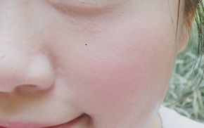 Biết mẹo nhỏ này bạn sẽ không bị bắt nắng và da luôn trắng hồng