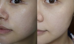 Đắp thứ này tuần 2 lần, da trắng hồng mà không cần tốn tiền mua kem