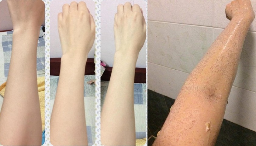 Da cháy nắng hay đen sạm đến đâu cũng trở nên sáng mịn ngay tức khắc