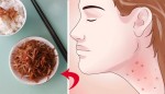 Bị ung thư vì 5 năm chắt chiu dành dụm tiền xây nhà cho chồng con
