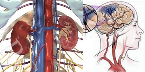 Cảnh báo nguy cơ mắc bệnh thận và đột quỵ từ món ăn người Việt nào cũng từng ăn