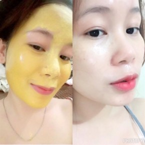 Tự làm sữa rửa mặt nghệ + tinh dầu xua mụn, nám, tàn nhang