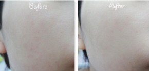 Đắp mặt nạ bằng kem tự chế tại nhà này để da trắng mịn sạch mụn