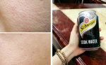 Se lỗ chân lông hiệu quả hơn laser chỉ bằng 1 lon soda rẻ tiền
